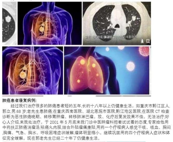 冉明医师创新国医精粹 铺就患者“健康之路”