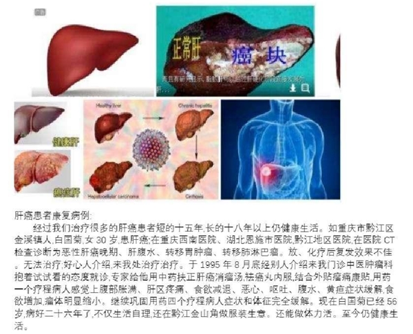 冉明医师创新国医精粹 铺就患者“健康之路”